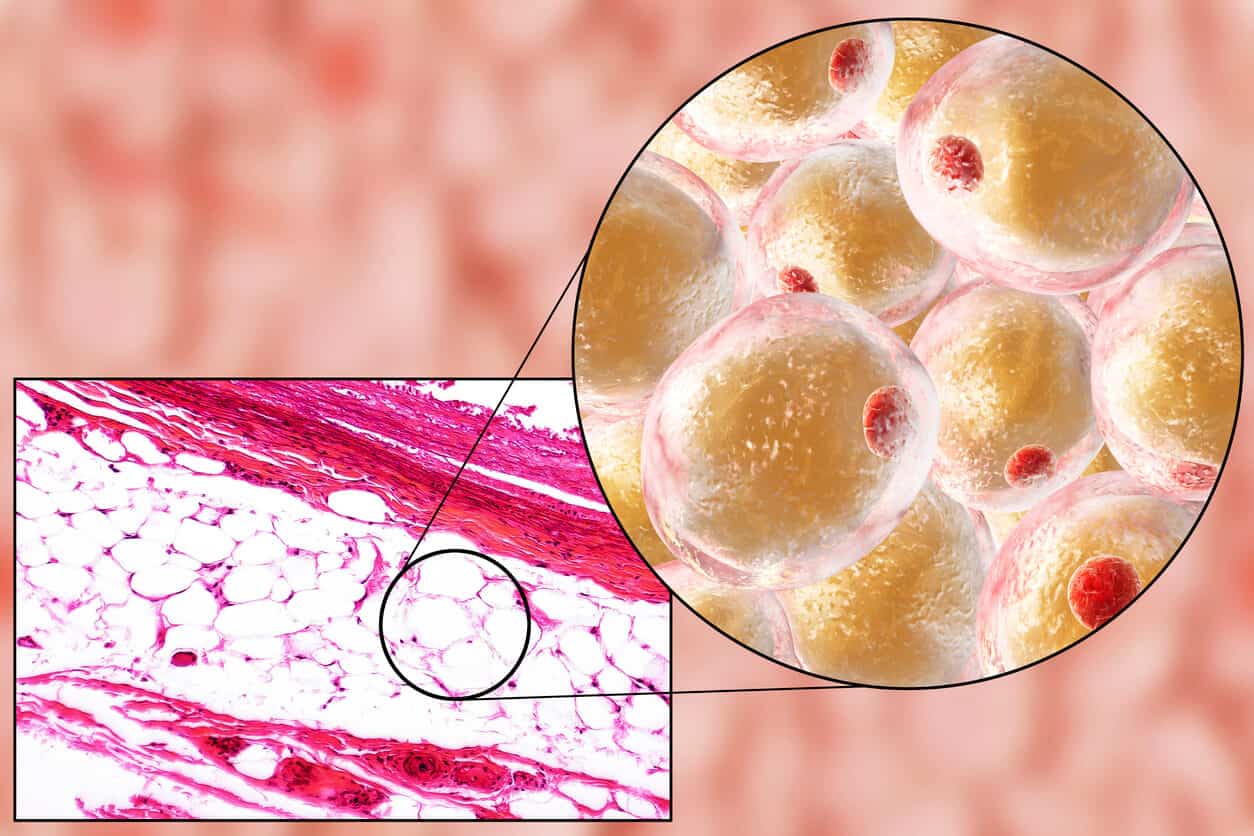 What happens to fat when we lose weight