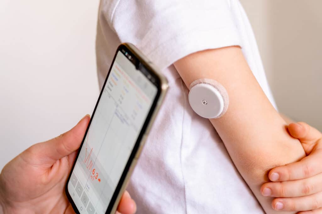 CGM for weight loss review